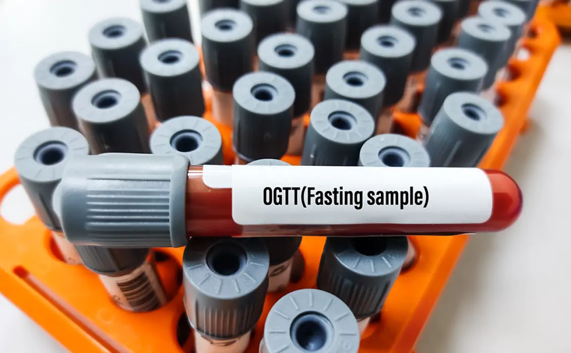Blood samples tube for oral glucose tolerance test